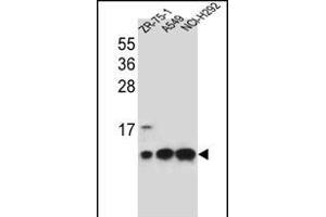 COX6B1 Antibody (C-term) (ABIN656270 and ABIN2845582) western blot analysis in ZR-75-1,A549,NCI- cell line lysates (35 μg/lane).