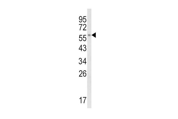 CYP8B1 Antikörper  (C-Term)