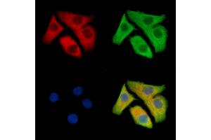 ABIN7095413 and ABIN7099470 staining Hela cells by IF/ICC. (Sclt1 Antikörper)