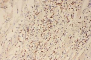 IHC analysis of Profilin 1 using anti-Profilin 1 antibody (ABIN3043603). (PFN1 Antikörper  (C-Term))