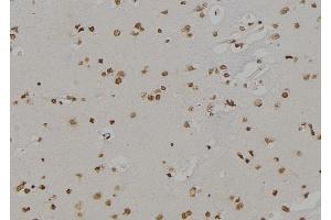 ABIN6259891 and ABIN6277140 at 1/100 staining Human brain tissue by IHC-P. (ALOX5 Antikörper  (C-Term))