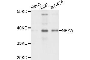 Western blot analysis of extracts of various cell lines, using NFYA antibody (ABIN4904531) at 1:1000 dilution. (NFYA Antikörper)