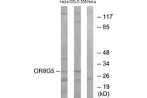 Western blot analysis of extracts from HeLa/COLO cells, using OR8G5 Antibody. (OR8G5 Antikörper  (AA 197-246))