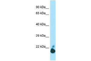 WB Suggested Anti-TIGIT Antibody Titration: 1. (TIGIT Antikörper  (C-Term))