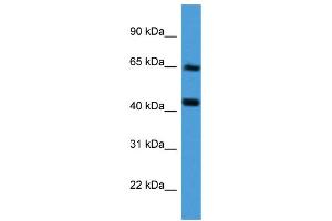 Western Blotting (WB) image for anti-Collagen, Type VIII, alpha 2 (COL8A2) (Middle Region) antibody (ABIN2788308)