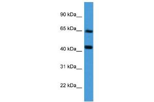 Western Blotting (WB) image for anti-Collagen, Type VIII, alpha 2 (COL8A2) (Middle Region) antibody (ABIN2788308) (COL8a2 Antikörper  (Middle Region))