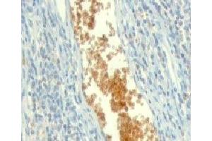 Formalin-fixed, paraffin-embedded human tonsil stained with AMPD3 antibody (clone ETAD3-1). (AMPD3 Antikörper)