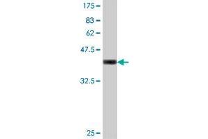 Western Blot detection against Immunogen (37. (GRIN1/NMDAR1 Antikörper  (AA 21-120))