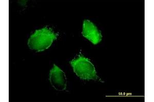 Immunofluorescence of purified MaxPab antibody to HNRPD on HeLa cell. (HNRNPD/AUF1 Antikörper  (AA 1-355))