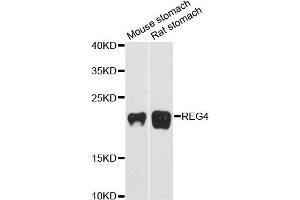 Western blot analysis of extracts of various cell lines, using REG4 antibody (ABIN6293540) at 1:3000 dilution. (REG4 Antikörper)