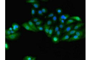 Immunofluorescent analysis of HepG2 cells using ABIN7154093 at dilution of 1:100 and Alexa Fluor 488-congugated AffiniPure Goat Anti-Rabbit IgG(H+L) (GSTA4 Antikörper  (AA 1-222))