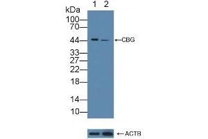 Knockout Varification: Lane 1: Wild-type A375 cell lysate, Lane 2: CBG knockout A375 cell lysate, Predicted MW: 45kd Observed MW: 45kd Primary Ab: 1 μg/mL Rabbit Anti-Human CBG Antibody Second Ab: 0.