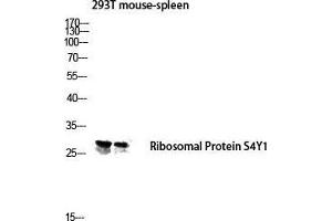 Western Blot (WB) analysis of 293T Mouse Spleen lysis using Ribosomal Protein S4Y1 antibody. (Ribosomal Protein S4Y1 (C-Term) Antikörper)