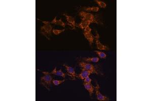 Immunofluorescence (IF) image for anti-Pyrroline-5-Carboxylate Reductase Family, Member 2 (PYCR2) (AA 271-320) antibody (ABIN7269766)