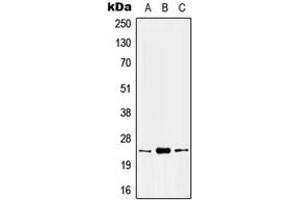Western blot analysis of Kallikrein 8 expression in HEK293T (A), mouse kidney (B), rat kidney (C) whole cell lysates.