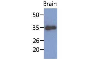 The extract of mouse brain (40ug) were resolved by SDS-PAGE, transferred to PVDF membrane and probed with anti-human KLF7 antibody (1:1000).