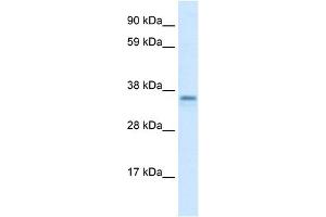 WB Suggested Anti-CGI-62 Antibody Titration:  1. (FAM164A Antikörper  (C-Term))