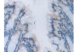 Immunohistochemistry (IHC) image for anti-Heparanase (HPSE) (AA 353-464) antibody (ABIN7438439)