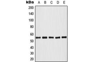 Western blot analysis of AKT (pT308) expression in HeLa colchicine-treated (A), HL60 (B), NIH3T3 (C), SP2/0 colchicine-treated (D), PC12 colchicine-treated (E) whole cell lysates. (AKT1 Antikörper  (pSer308))