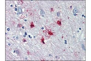 Human Brain, cortex: Formalin-Fixed, Paraffin-Embedded (FFPE) (alpha 1 Adrenergic Receptor Antikörper  (AA 206-270))