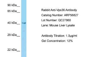 Western Blotting (WB) image for anti-Vacuolar Protein Sorting 36 (VPS36) (N-Term) antibody (ABIN2786923) (VPS36 Antikörper  (N-Term))