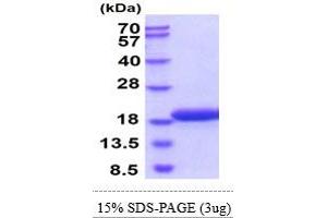 SDS-PAGE (SDS) image for Synuclein, gamma (Breast Cancer-Specific Protein 1) (SNCG) (AA 1-123) protein (His tag) (ABIN7281290)