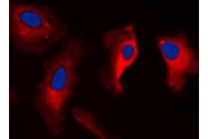 Immunofluorescent analysis of MAST3 staining in HepG2 cells.