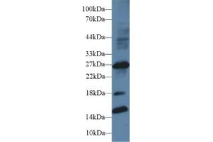 Detection of IGFBP1 in Human Placenta lysate using Polyclonal Antibody to Insulin Like Growth Factor Binding Protein 1 (IGFBP1) (IGFBPI Antikörper  (AA 112-262))