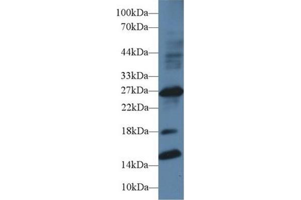 IGFBPI antibody  (AA 112-262)
