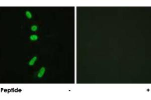 Immunofluorescence analysis of HeLa cells, using SF1 polyclonal antibody . (Splicing Factor 1 Antikörper)