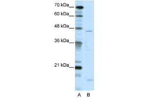 WB Suggested Anti-TRIP13  Antibody Titration: 5. (TRIP13 Antikörper  (C-Term))