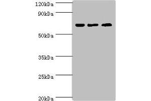 Western blot All lanes: PIAS2 antibody at 2 μg/mL Lane 1: A431 whole cell lysate Lane 2: HepG2 whole cell lysate Lane 3: Mouse brain tissue Secondary Goat polyclonal to rabbit IgG at 1/10000 dilution Predicted band size: 69, 64, 46 kDa Observed band size: 69 kDa (PIAS2 Antikörper  (AA 532-621))