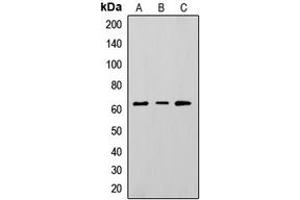 Western blot analysis of CD73 expression in HepG2 (A), K562 (B), A375 (C) whole cell lysates. (CD73 Antikörper  (Center))
