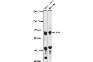 Western blot analysis of extracts of various cell lines, using CLPX antibody (ABIN7266418) at 1:1000 dilution. (CLPX Antikörper  (AA 500-600))