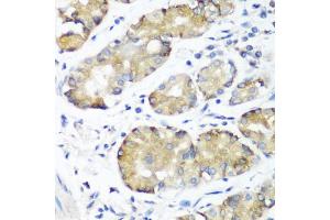Immunohistochemistry of paraffin-embedded human stomach using NOTCH2 antibody. (NOTCH2 Antikörper)