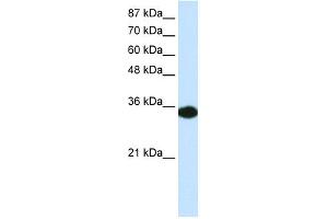 WB Suggested Anti-HOXD4 Antibody Titration: 0. (HOXD4 Antikörper  (C-Term))