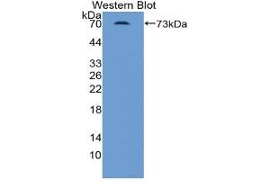 Western blot analysis of the recombinant protein. (INHBB Antikörper  (AA 50-404))