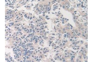 Immunohistochemistry (IHC) image for anti-Coagulation Factor VIII (F8) (AA 1887-2044) antibody (ABIN7438070)