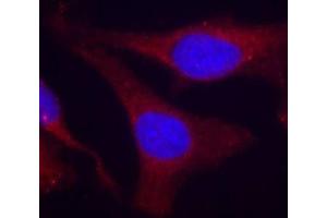 Immunofluorescence staining of methanol-fixed HeLa cells using Phospho-PTPN6-Y536 antibody (ABIN2988271). (SHP1 Antikörper  (pTyr536))
