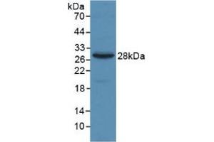 Figure. (alpha 2 Macroglobulin Antikörper  (AA 616-856))