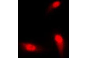 Immunofluorescent analysis of SMAD3 staining in HeLa cells.