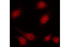 ABIN6275357 staining A549 by IF/ICC. (PIP5K1C Antikörper  (Internal Region))