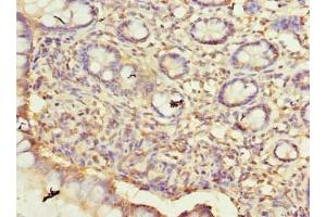 Immunohistochemistry of paraffin-embedded human small intestine tissue using ABIN7165103 at dilution of 1:100 (ARMCX6 Antikörper  (AA 28-300))