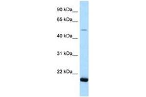 Image no. 1 for anti-seryl-tRNA Synthetase 2, Mitochondrial (SARS2) (AA 108-157) antibody (ABIN6747848) (SARS2 Antikörper  (AA 108-157))