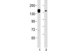Western blot testing of KDM6A antibody at 1:2000 dilution.