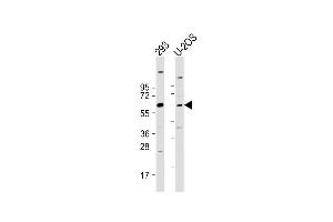 All lanes : Anti-TRIM6 Antibody (N-term) at 1:2000 dilution Lane 1: 293 whole cell lysate Lane 2: U-2OS whole cell lysate Lysates/proteins at 20 μg per lane.