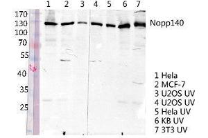 Western Blot (WB) analysis of specific lysis using Nopp140 Polyclonal Antibody. (NOLC1 Antikörper  (C-Term))