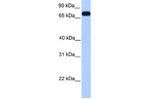 WB Suggested Anti-PRICKLE3 Antibody Titration:  0. (PRICKLE3 Antikörper  (C-Term))