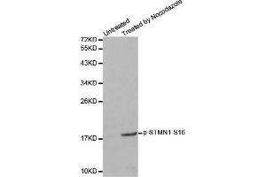 Western blot analysis of extracts from 293 cells, using Phospho-STMN1-S16 antibody. (Stathmin 1 Antikörper  (pSer16))