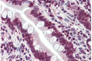 Human Small Intestine (formalin-fixed, paraffin-embedded) stained with LASS6 antibody ABIN396945 at 5 ug/ml followed by biotinylated goat anti-rabbit IgG secondary antibody ABIN481713, alkaline phosphatase-streptavidin and chromogen. (CERS6 Antikörper  (N-Term))